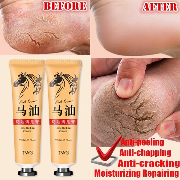 Kem Dầu Ngựa 30g Giúp Loại Bỏ Vết Nứt Nẻ Và Khô Da Chân Hiệu Quả