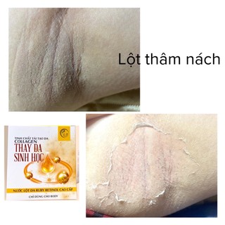 (set peel vùng bikini) Thay da tái tạo da cao cấp / lột da sinh học retinol / khử thâm da chai lỳ / tẩy da chết Cozy