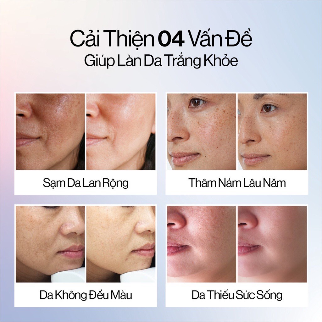 Bộ 4 sản phẩm dưỡng trắng và phục hồi da Gilaa Saffron Tone Up Repair