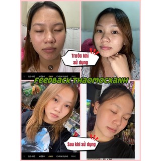 Serum thảo mộc xanh x5 (𝐅𝐫𝐞𝐞𝐬𝐡𝐢𝐩) tặng tắm trắng 50ml