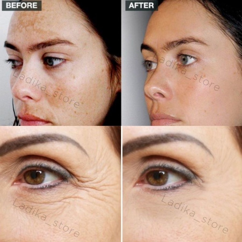 Kem RETINOL COLLAGEN Dưỡng Ẩm Chống Nếp Nhăn Lão Hóa 50g