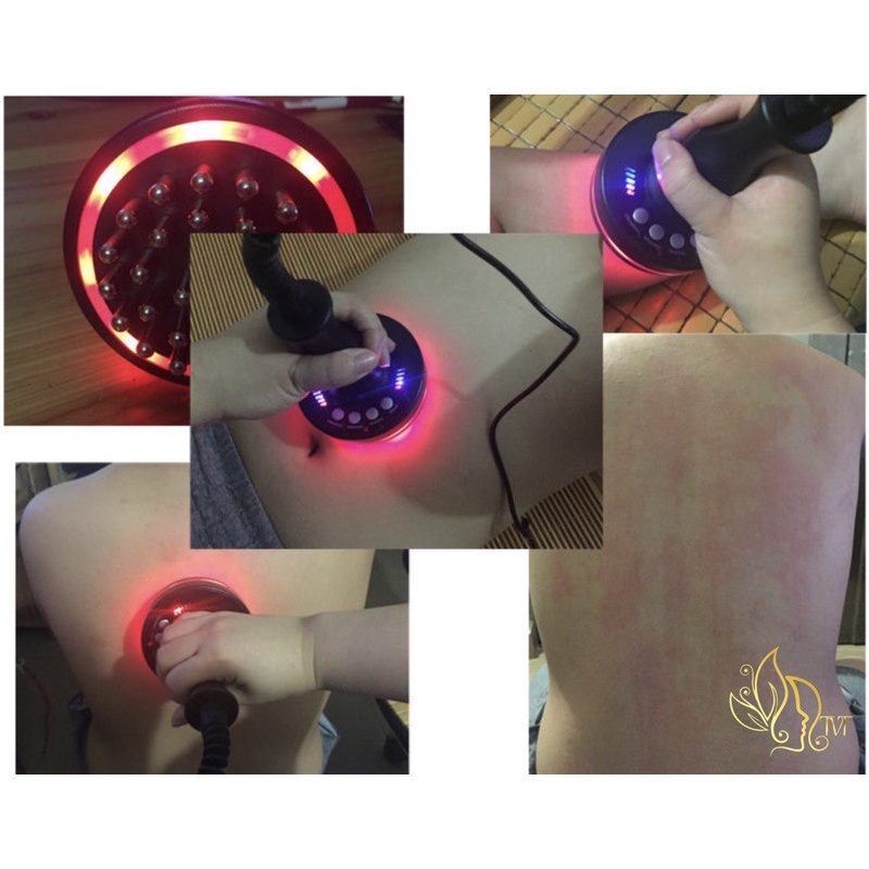 Máy giảm béo mini hồng ngoại và cầm tay RF