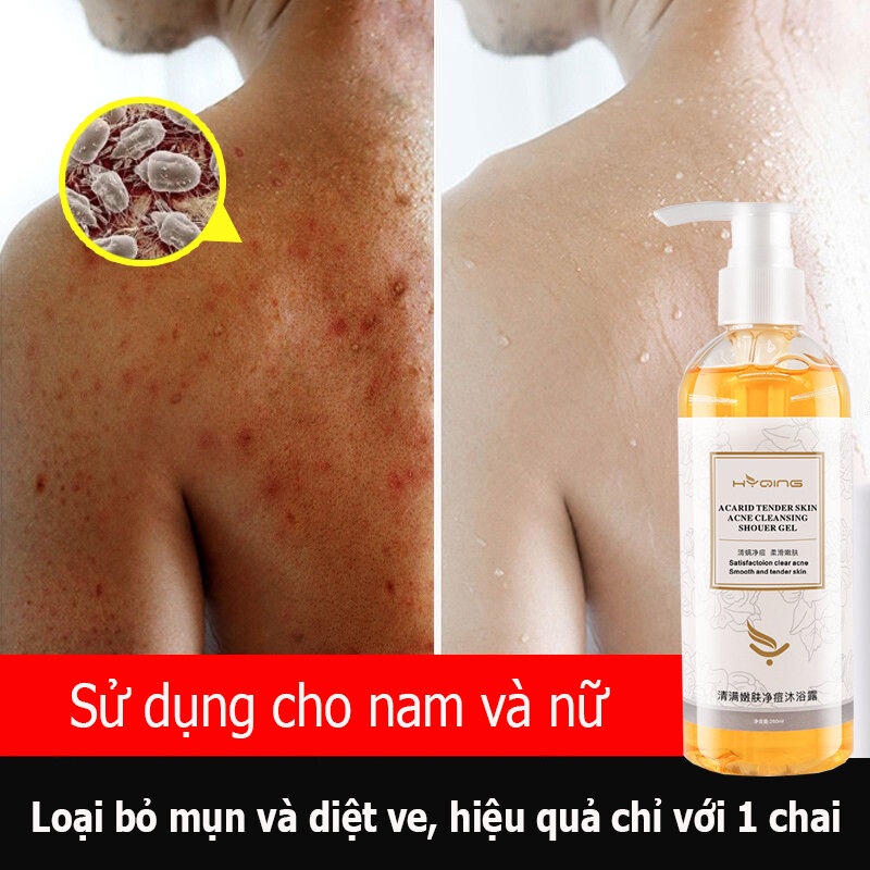 Sữa tắm kháng khuẩn,sữa tắm trắng da, loại bỏ các bệnh viêm nang lông, mụn lưng, mụn ở ngực, giảm ngứa, diệt ve