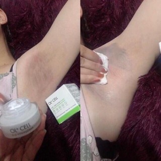 Hộp kem tri thâm nách thâm môi thâm đầu gối ol-cell