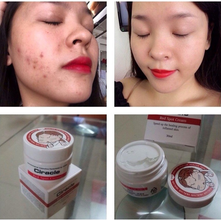 Kem Mụn Ciracle Red Spot Healing Cream 30ml