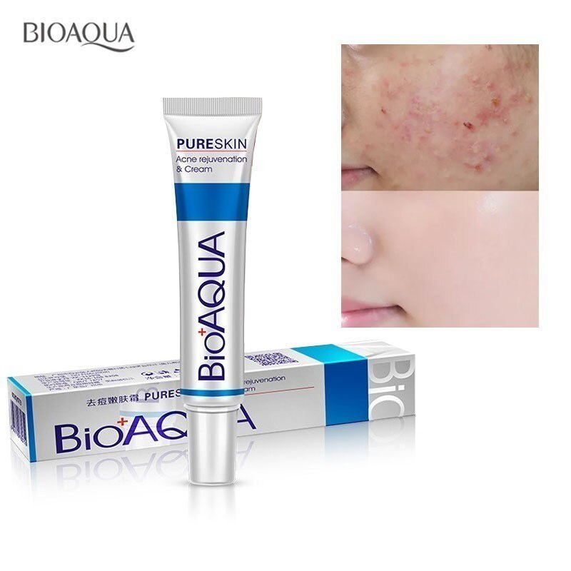 trị thâm mụn thuốc trị mụn ẩn thuốc trị mụn lưng Bioaqua 30G Điều Trị Mụn Đầu Đen Remova Ngăn Ngừa Mụn Kiểm Soát Dầu Thu Nhỏ Lỗ Chân Lông Thâm Sẹo Loại Bỏ Chăm Sóc Mặt Làm Trắng Da