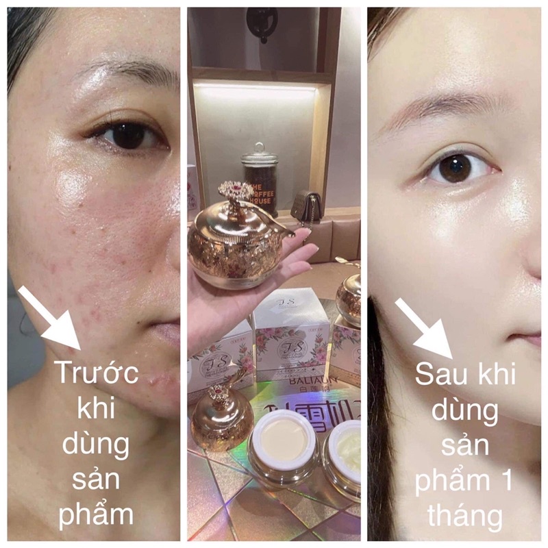 Combo Ngày Đêm Face FS Huyết Rồng Dưỡng Trắng Da, Mờ Nám Tàn Nhang