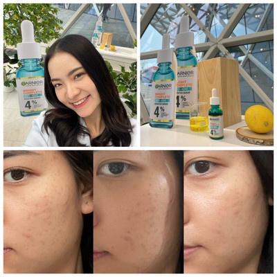 Tinh chất dưỡng GARNIER Skin Naturals Bright Complete Anti-Acne Booster Serum giảm mụn hiệu quả - Thái Lan