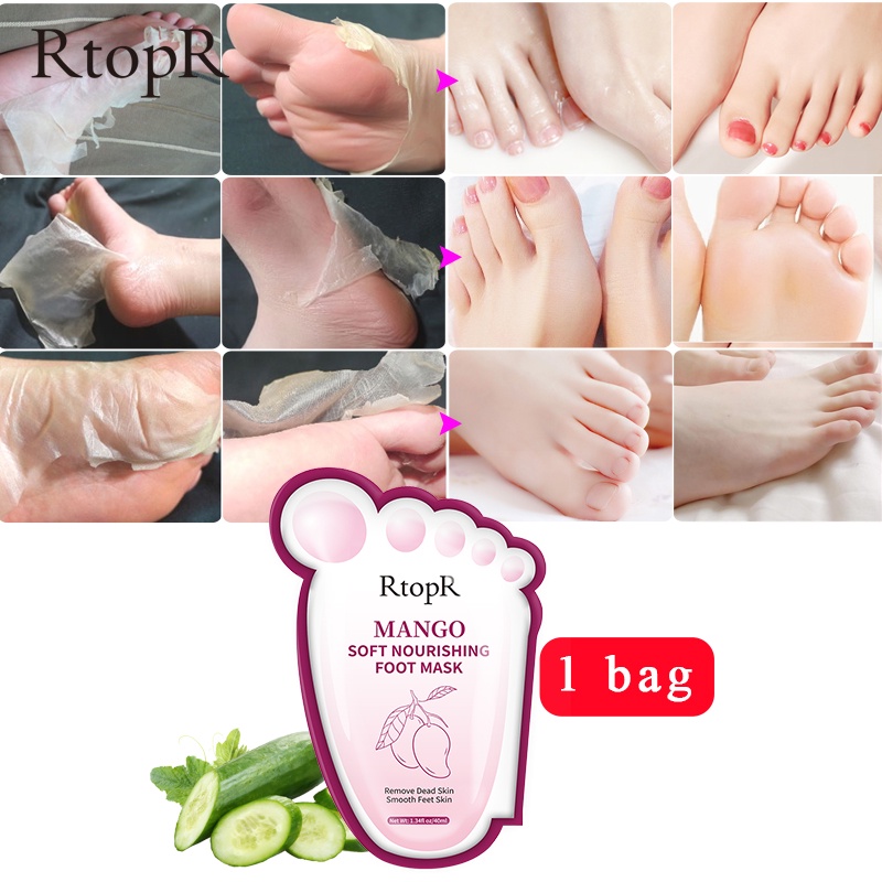 Cặp Mặt Nạ Chân RtopR Tẩy Da Chết 2-7 Ngày ủ Thay Da Chân Foot Peling Mask Loại Bỏ Lớp Da Thô Cứng Hỗ Trợ Làm Sáng Da Cho Chân 40ml