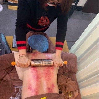 Cây lăn ngãi cứu đồng đôi