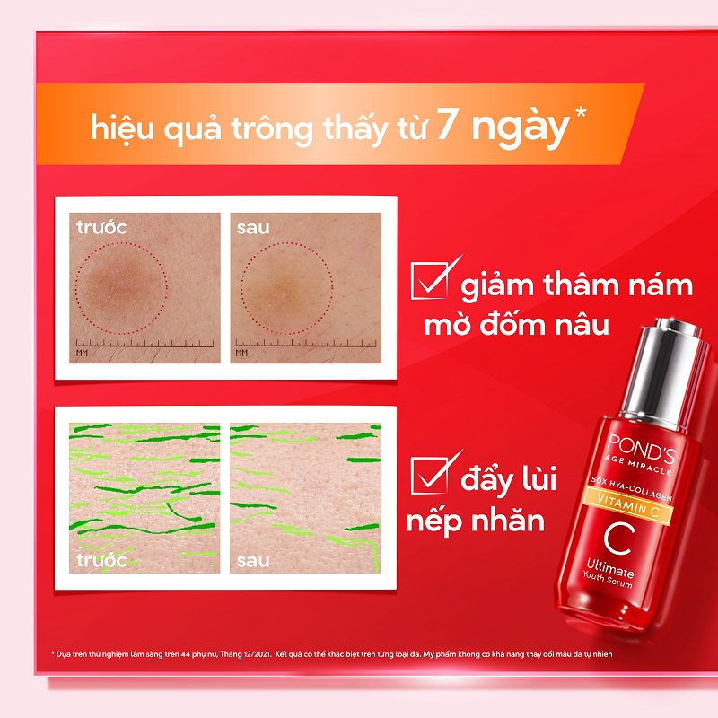 Serum tinh chất dưỡng sáng mờ đốm nâu POND'S Age Miracle Ultimate Youth với Vitamin C HA Collagen 30g