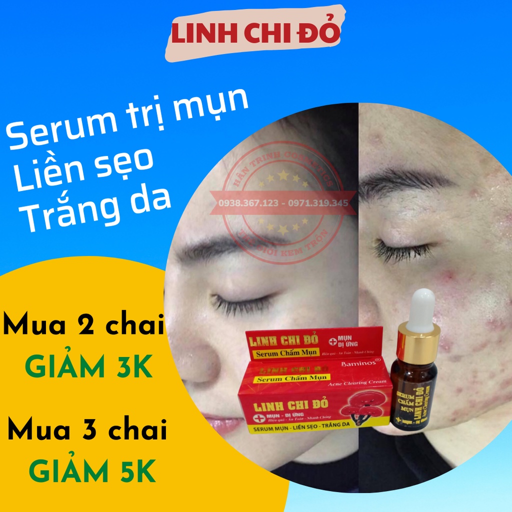 Serum Chấm Mụn, Serum Chấm Mụn Linh Chi Đỏ Baminos 10ml