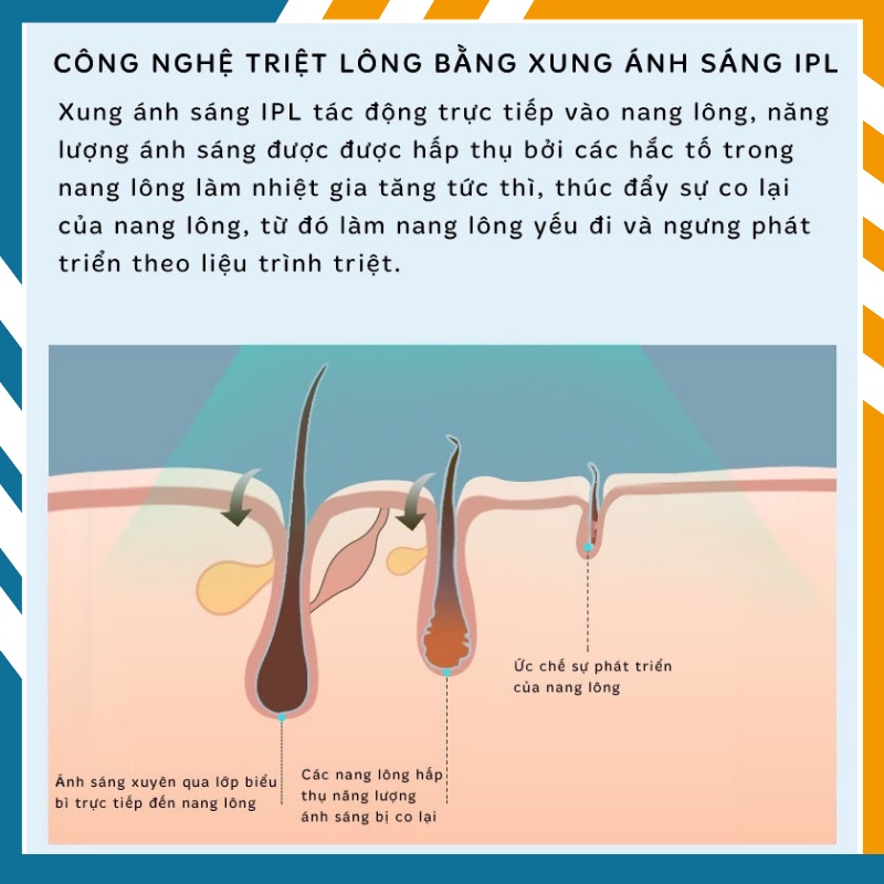 Máy Triệt Lông Vĩnh Viễn 8 Cấp - Trẻ Hóa, Xóa Sắc Tố Đen Trên Da Luxio A113,Công nghệ PIAS Tăng 300% Hiệu Quả