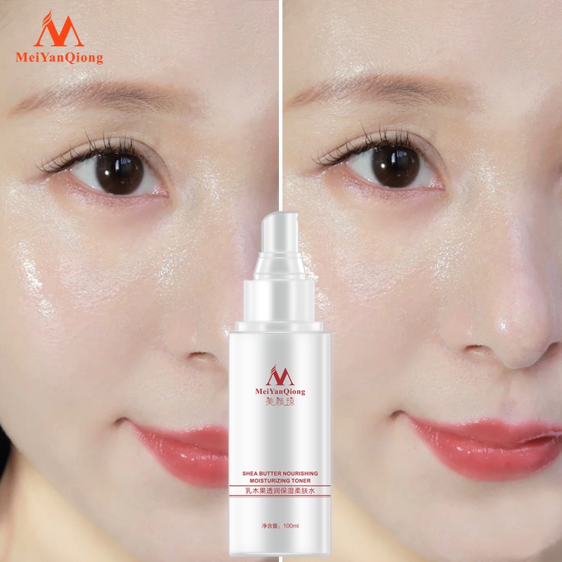 Nước Hoa Hồng MeiYanQiong Tinh Chất Bơ Hạt Mỡ Axit Hyaluronic Dưỡng Ẩm Làm Trắng Da 100ml