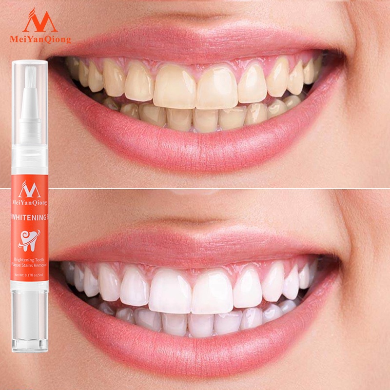 Set 5 Bút Làm Trắng Răng MeiYanQiong Loại Bỏ Các Vết Bám Mảng
