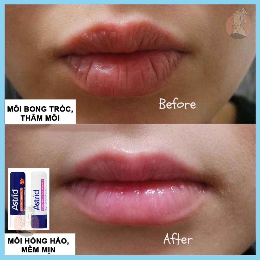 Son dưỡng môi mỡ hươu Astrid Multivitamin tẩy da chết, tái tạo môi mềm, ẩm, Son dưỡng Astrid - Sarah Beaute