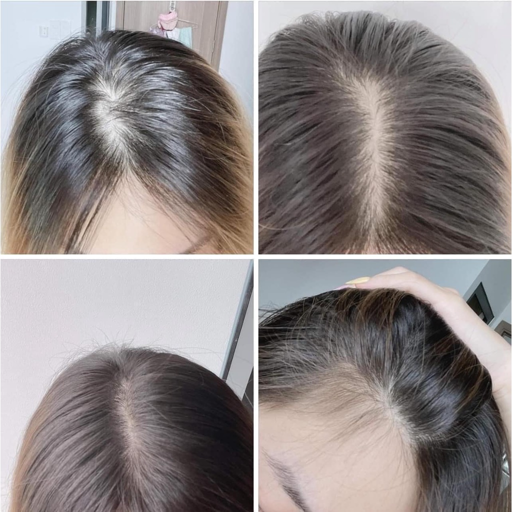 Xịt mọc tóc Mino.Xidil Bailleul