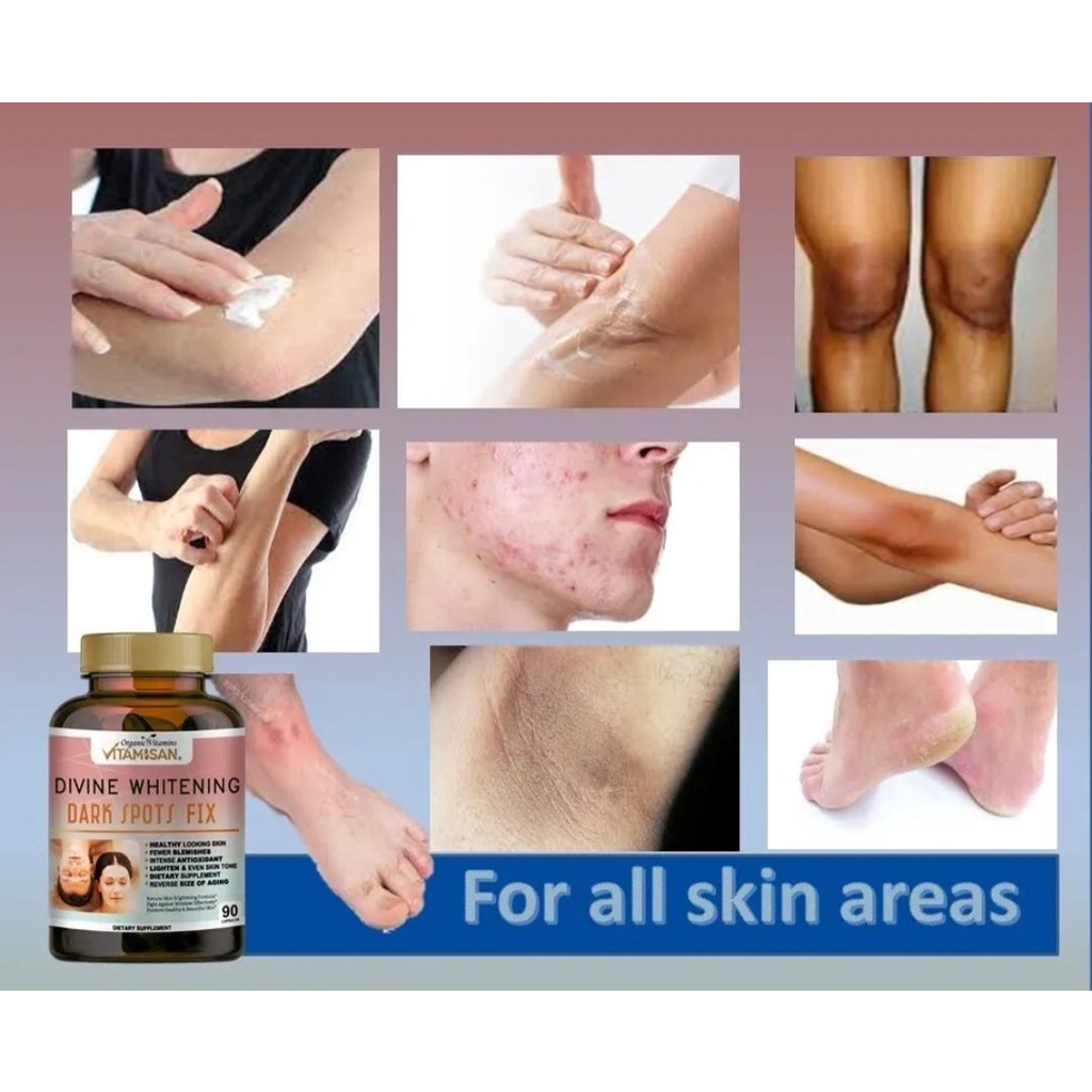 Viên uống trắng da L-Glutathione 3000mg giúp giảm thâm đặc biệt cho mọi khu vực trên cơ thể, giảm nám tàn nhangvitamisan