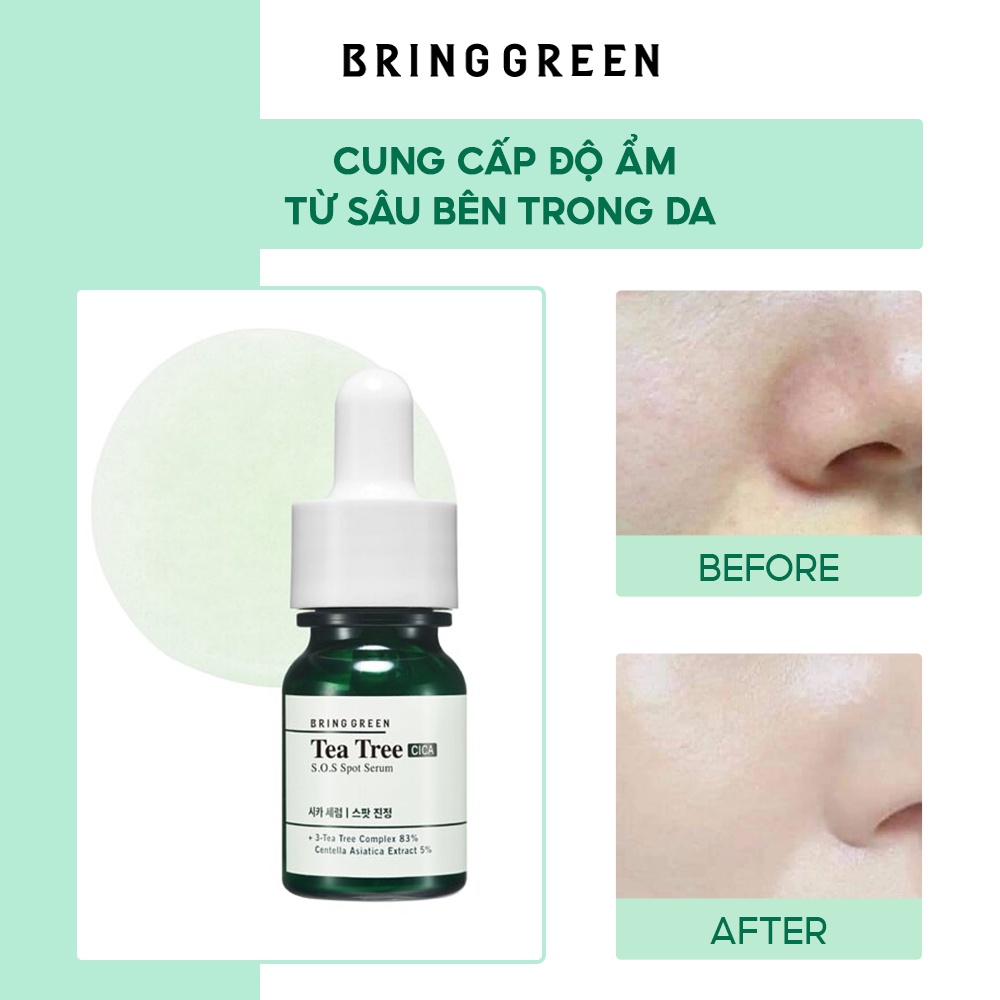 Tinh Chất Chấm Mụn Tràm Trà Bring Green Tea Tree Cica SOS Spot Serum 13ml Double Set (FOC Spot Patch)