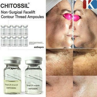 Chỉ tơ tằm chitosil chính hãng