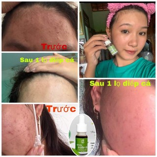 SERUM DIẾP CÁ IGREEN