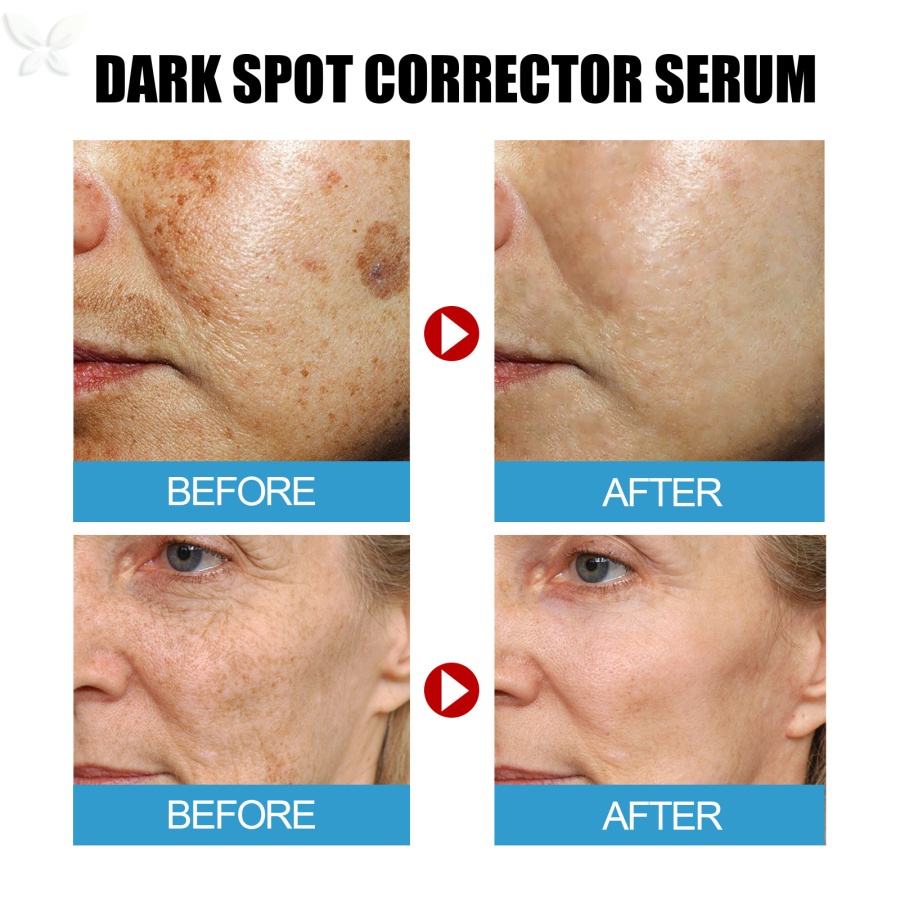 Jmmz serum Làm Trắng Da Loại Bỏ Tàn Nhang 30ml Tiện Dụng