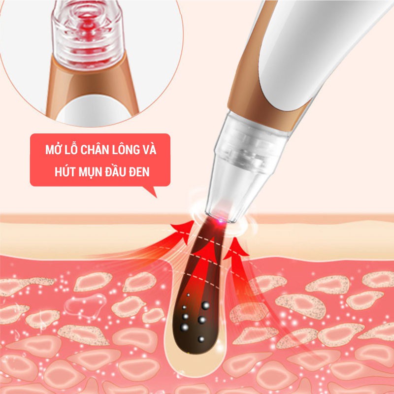 Máy hút mụn đầu đen, mụn cám, làm sạch lỗ chân lông, massage chườm nóng trẻ hóa làn da