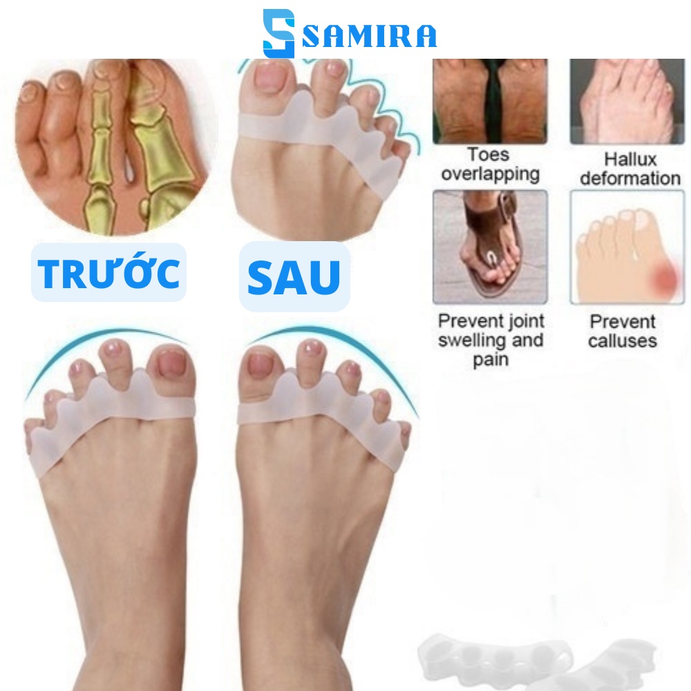 Dụng cụ silicon tách ngón chân giảm đau chỉnh hình ngón chân cái siêu bền cao cấp SA14