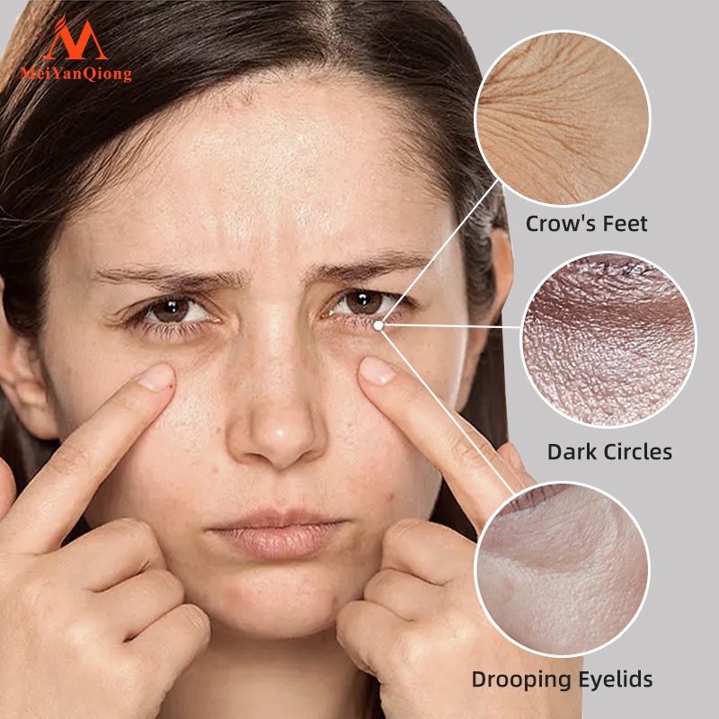 MeiYanQiong Tái TạoTinh Chất Dưỡng Da Vùng Mắt Chống Lão Hóa Loại Bỏ Nếp Nhăn Rejuvenating eye Serum12ml