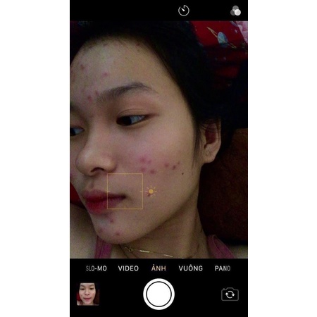[Chính Hãng] Thanh Tô Combo Serum M.ụ.n + Kem Face