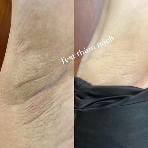 Serum NANO AHA 15ml - Khử Thâm Hiệu Quả Sau 2 Tuần