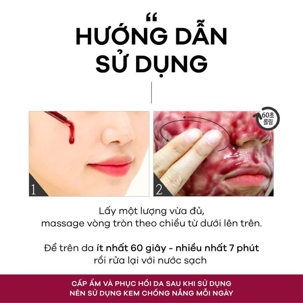 Tẩy da chết hoá học So Natural Red Peel Tingle Serum