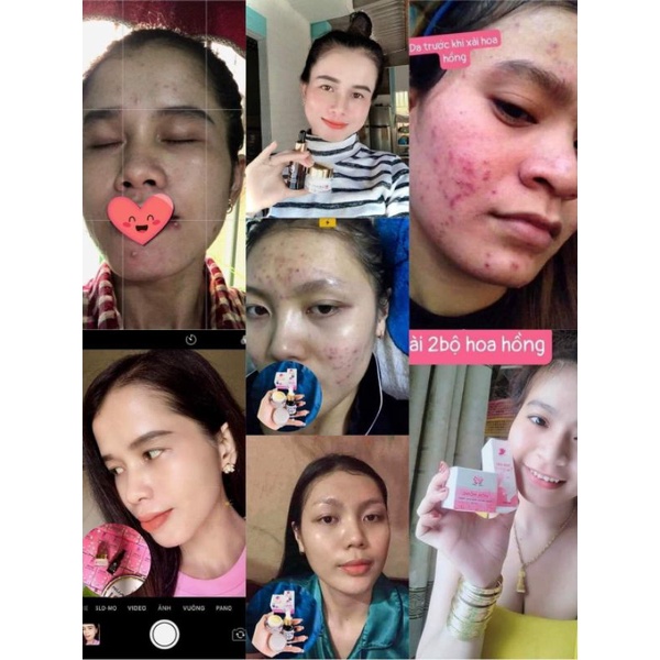 COMBO face hoa hồng