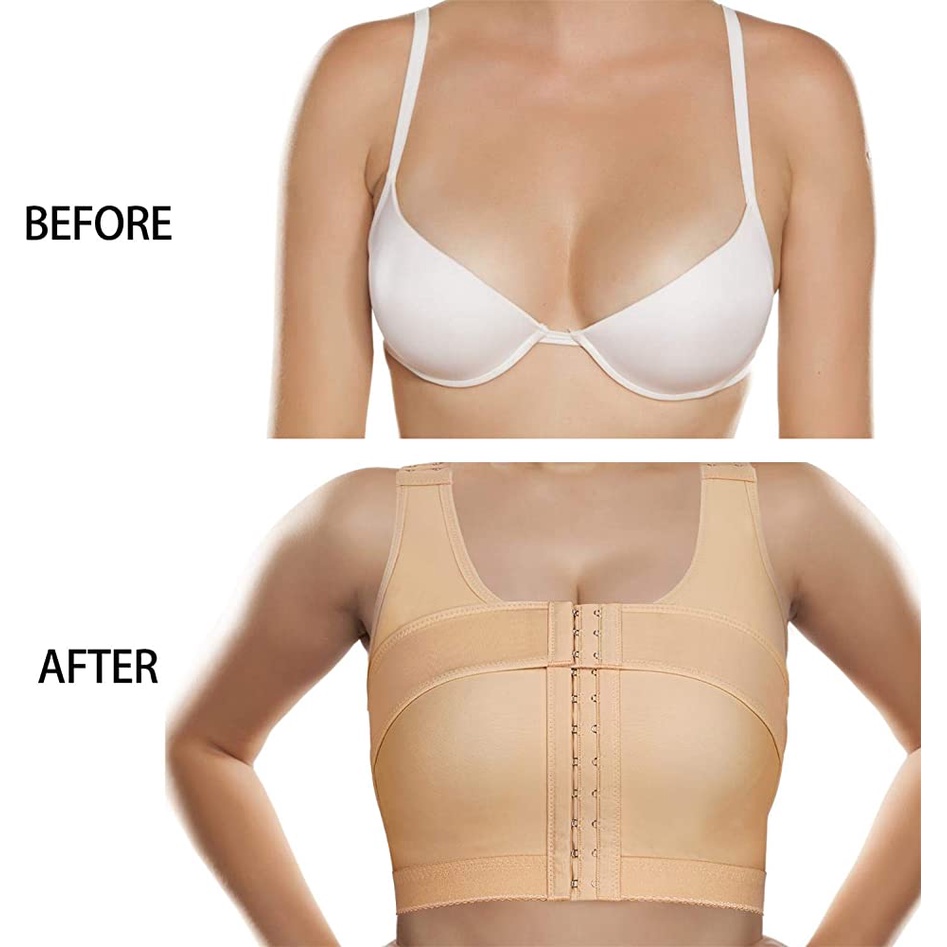 Áo Định Hình Ngực Sau Phẫu Thuật Nâng Ngực Ôm Sát Vòng 1 Tôn Dáng