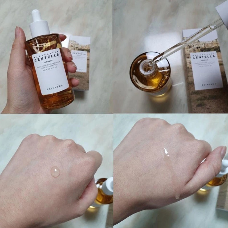 Serum rau má skin1004 100ml Làm dịu làn da nhạy cảm mụn trứng cá