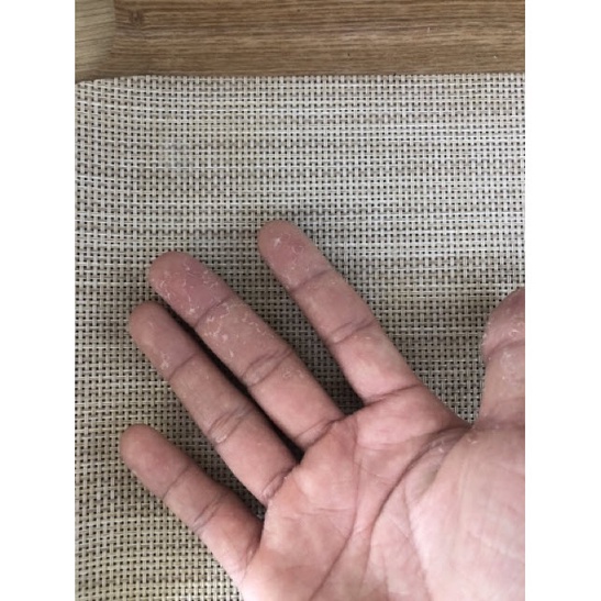 Thảo dược tốt đánh bay bong da đầu ngón tay ngón chân, lòng bàn tay, bàn chân