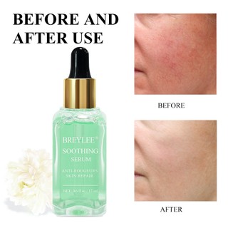 Chai serum BREYLEE hồi phục da 17ml