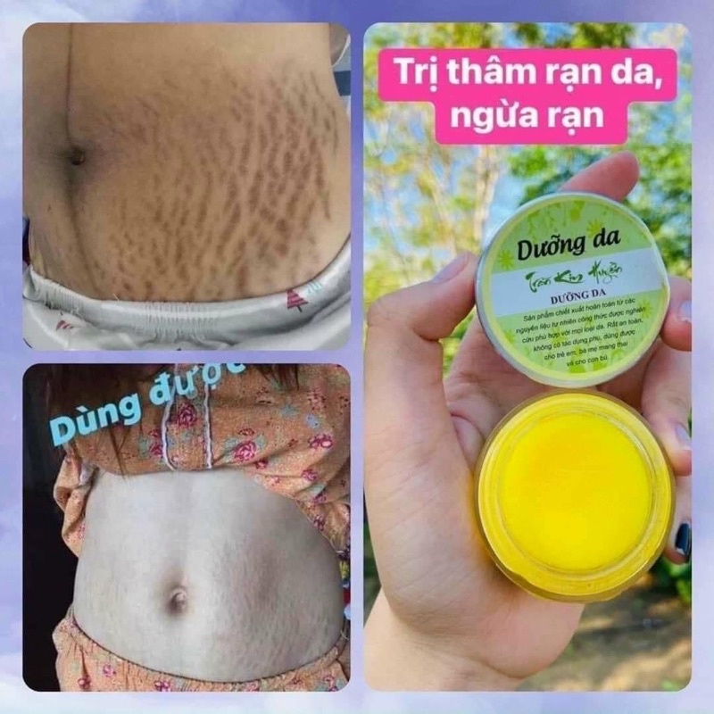 dưỡng da rạn tkh