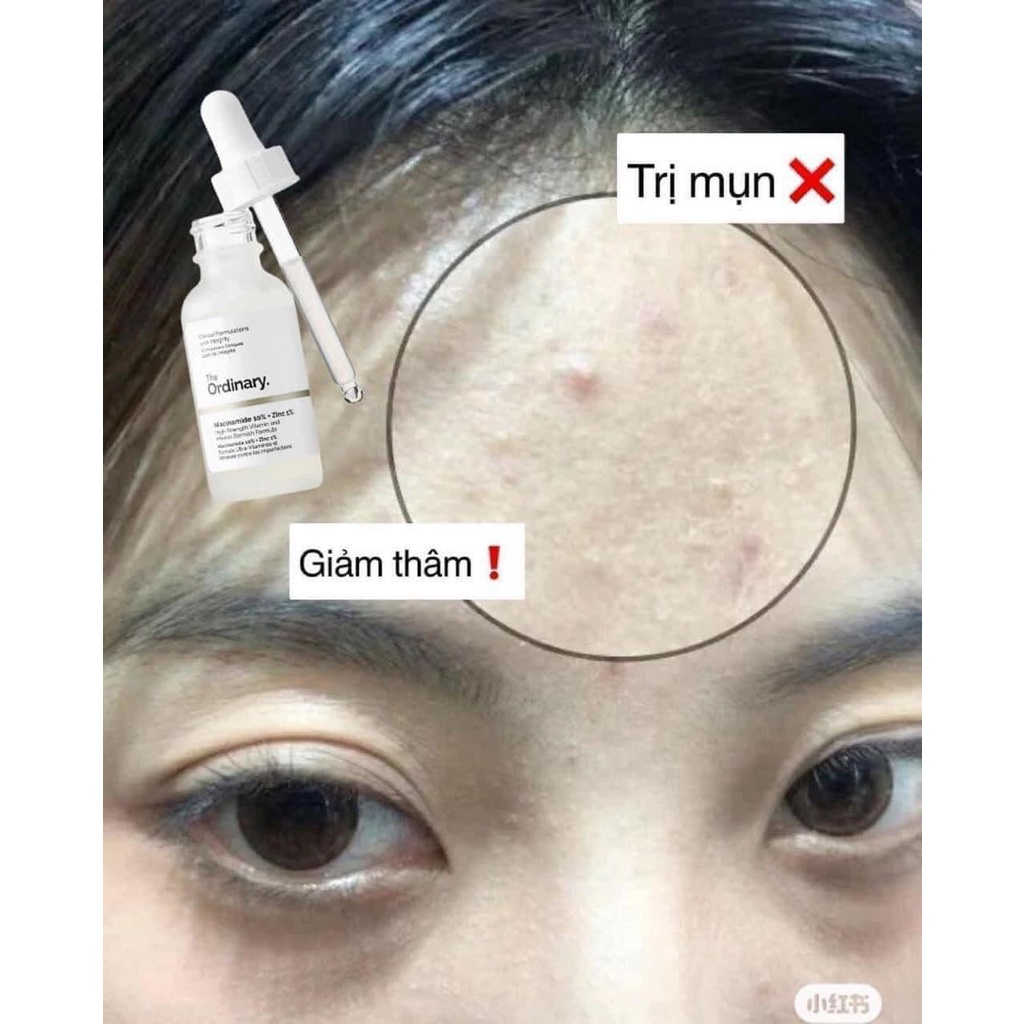 Tinh chất dưỡng sáng da TO 10% + Zinc 1%