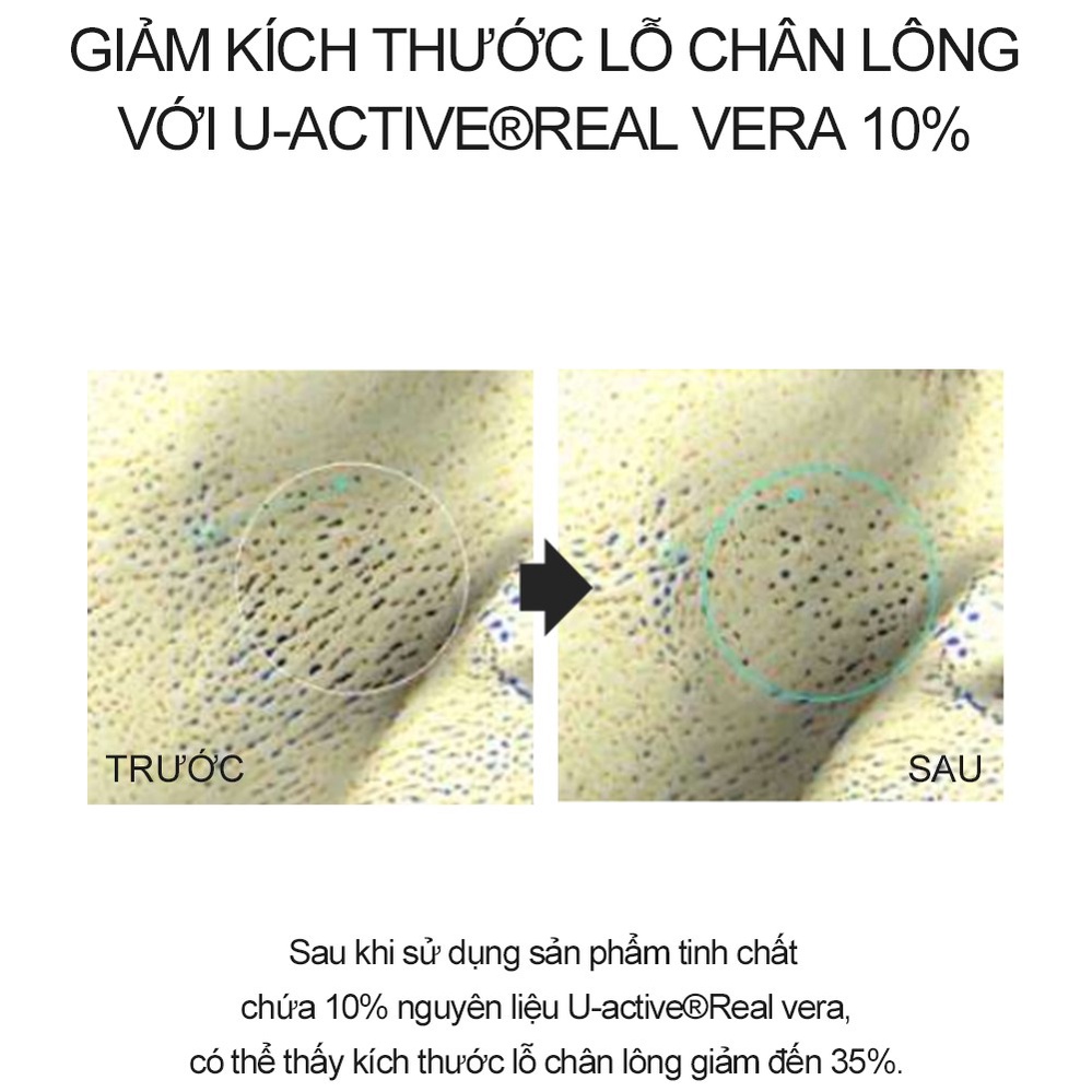 Tinh chất lô hội Derma Factory Real - Vera Pore Serum 30ml