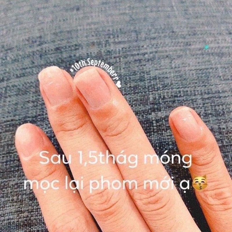 Kem bôi nấm móng tay, chân Thái Lan