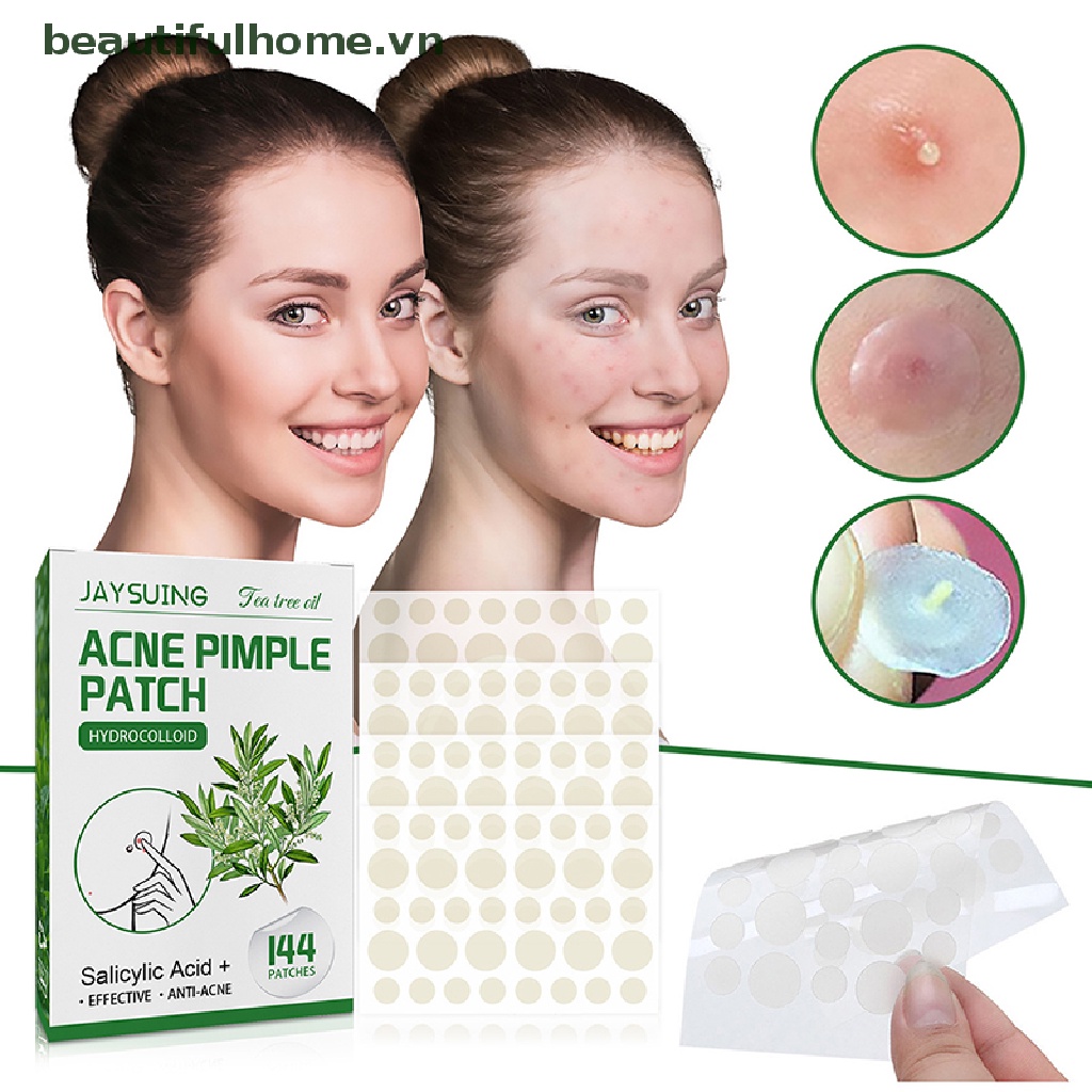 Bộ 144 Miếng Dán Hỗ Trợ Giảm Mụn Vô Hình Nhanh Chóng