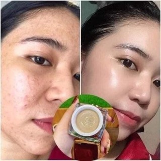 [CHÍNH HÃNG 100%] Cao mụn sâm đỏ MEEA ORGANIC full 15g