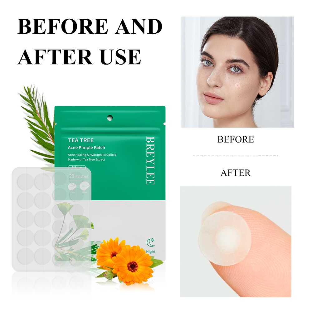 Miếng Dán Mụn BREYLEE Cao Cấp Chống Thấm Nước Dùng Ban Ngày Đêm
