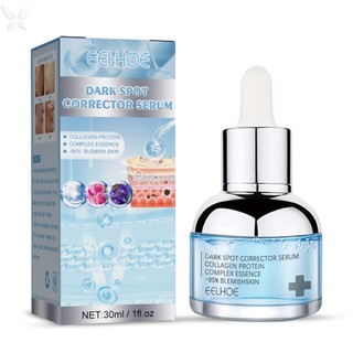 Dark Spot Corrector Facial Serum Làm trắng tàn nhang Loại bỏ mạnh mẽ Chloasma Melanin Fade Dark Spots Sắc tố Tinh chất Chăm sóc da mặt 30ml