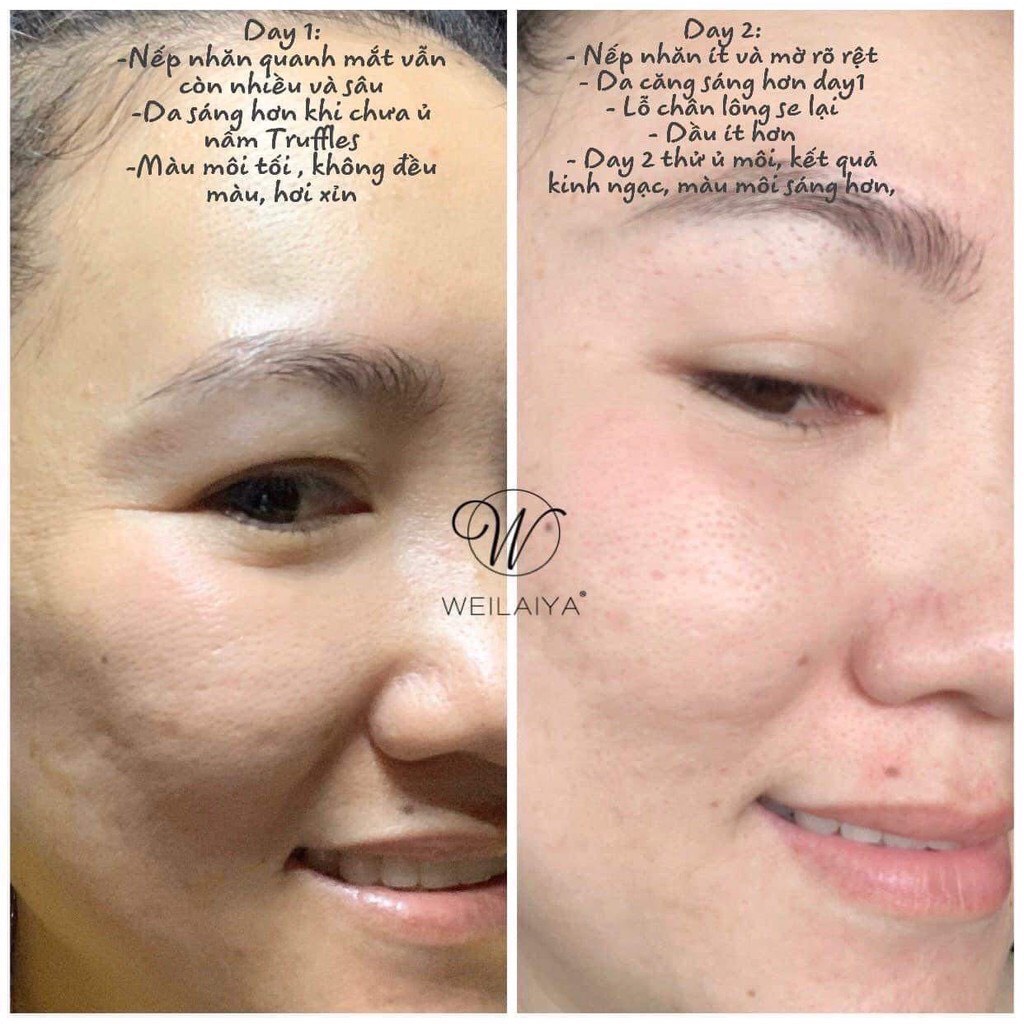 Mặt Nạ Ngủ Ủ Nấm Truffle Weilaiya, Dưỡng Da Trắng Sáng, Chống Lão Hóa, Xóa Nhăn Nâng Cơ - 50 ml [ CHÍNH - HÃNG 100% ]