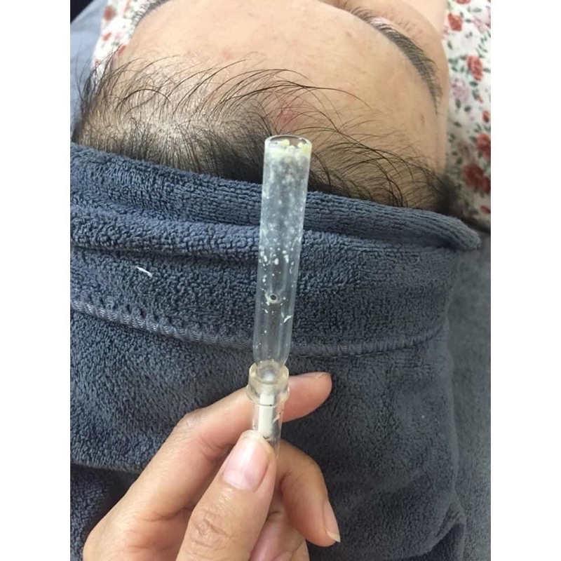 🔴 Ống Thuỷ Tinh Hút Dầu Chuyên Dùng Trong Spa - TMV