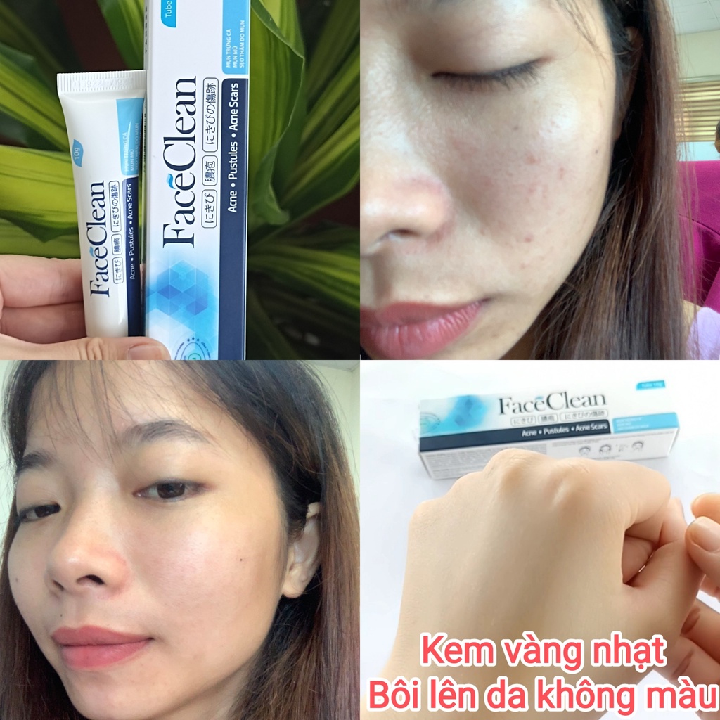 Ken bôi ngừa mụn, mờ thâm sẹo FACE CLEAN - An châu