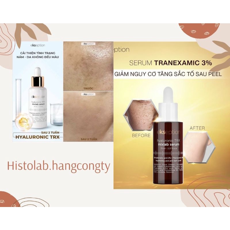 Serum dưỡng trắng sáng da, mờ thâm, cải thiện sạm nám Ekseption Hyaluronic TRX