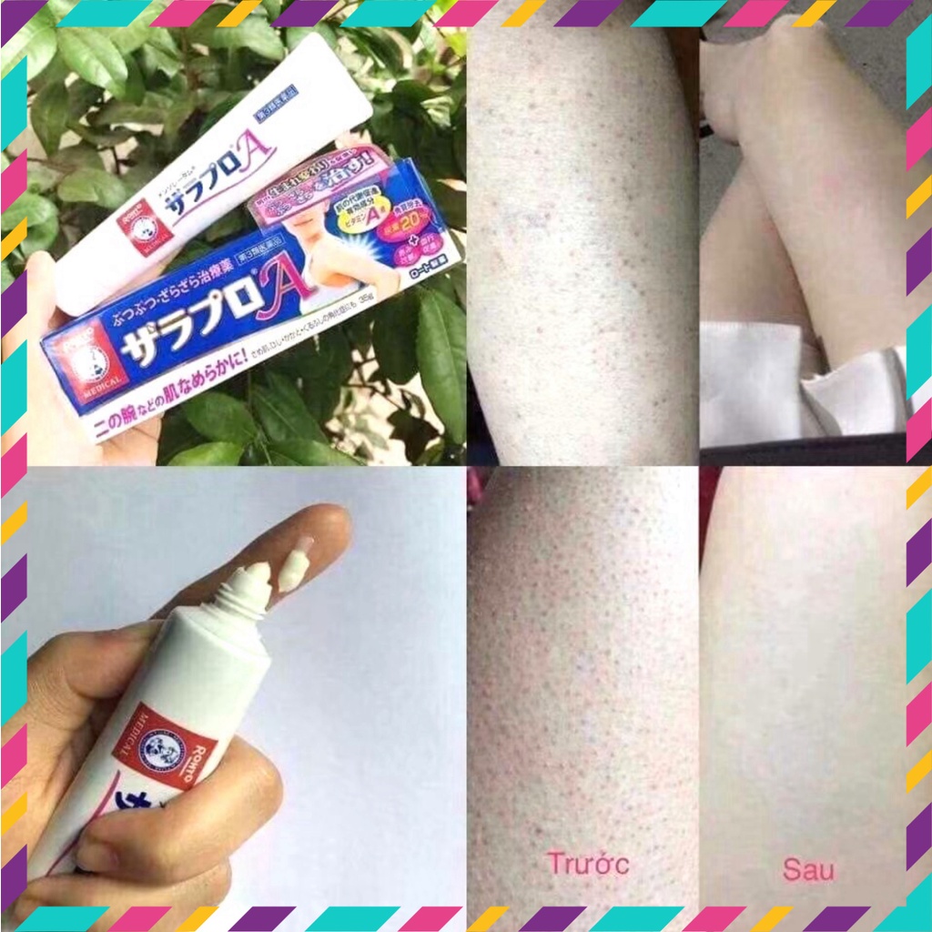 Kem Xóa Viêm Nang Lông Rohto Nhật Bản